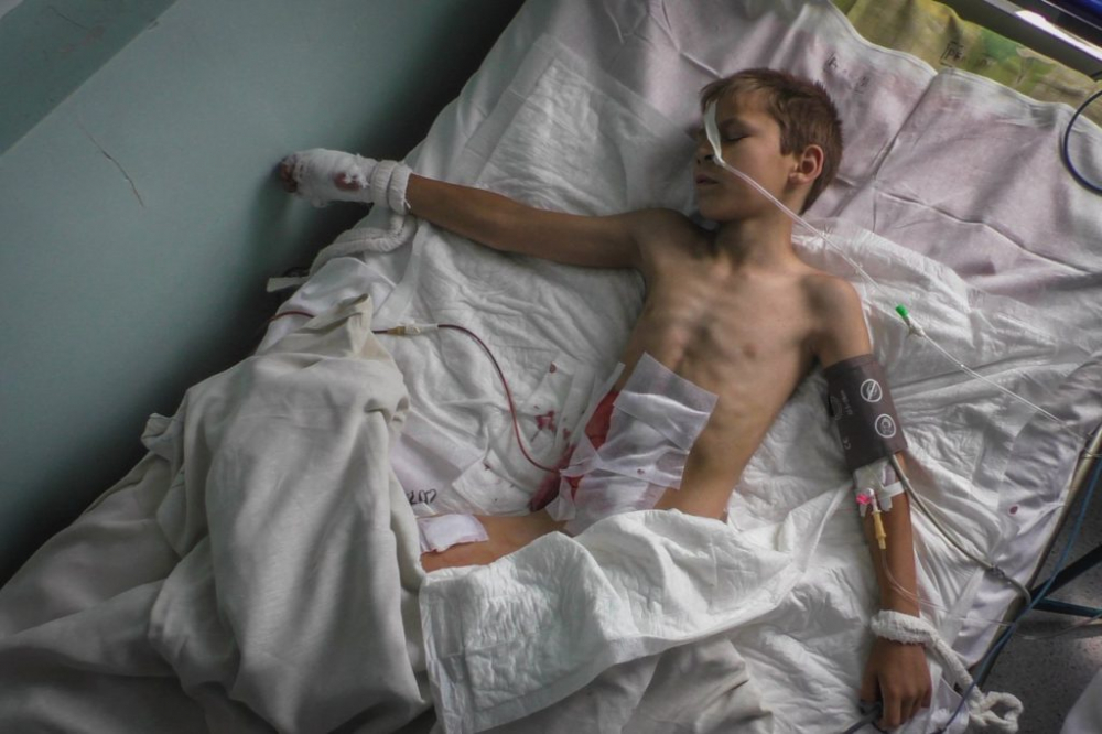 Что творят каратели ВСУ на Донбассе: война глазами детей