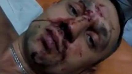Суд Линча: в Киеве пытались убить ветерана АТО Суд Линча: в Киеве пытались убить ветерана АТО