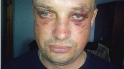ВСУшники избили на блокпосту Мариуполя пьяных майоров и полковников СБУ