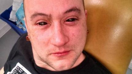 Глазные капли Chlorin6 для ночного видения Глазные капли Chlorin6 для ночного видения