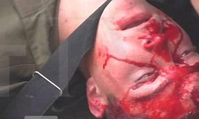 Необъявленная война в Киеве и в/на всей Украине Необъявленная война в Киеве и в/на всей Украине
