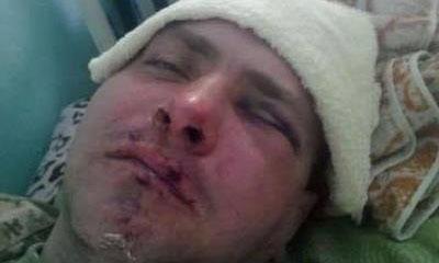 Атошника c позывным Докер избили битами в Одесской области за Донбасс Атошника c позывным Докер избили битами в Одесской области за Донбасс