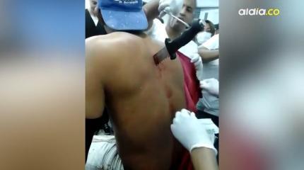 Мужчина с ножом в спине сам пришел в больницу Мужчина с ножом в спине сам пришел в больницу
