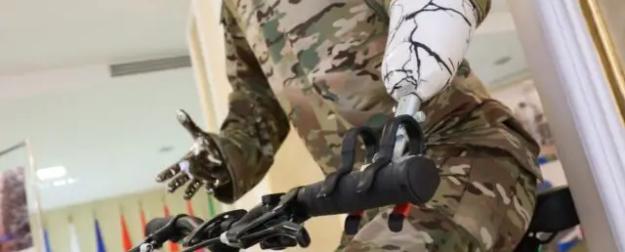 Технологии для жизни: в регионах России запустили сеть протезирования