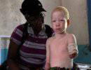 Ужас тысяч обреченных: негров-альбиносов убивают ради денег