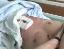 Один из раненых милиционеров участниками "євромайдану" в Херсоне умер в больнице