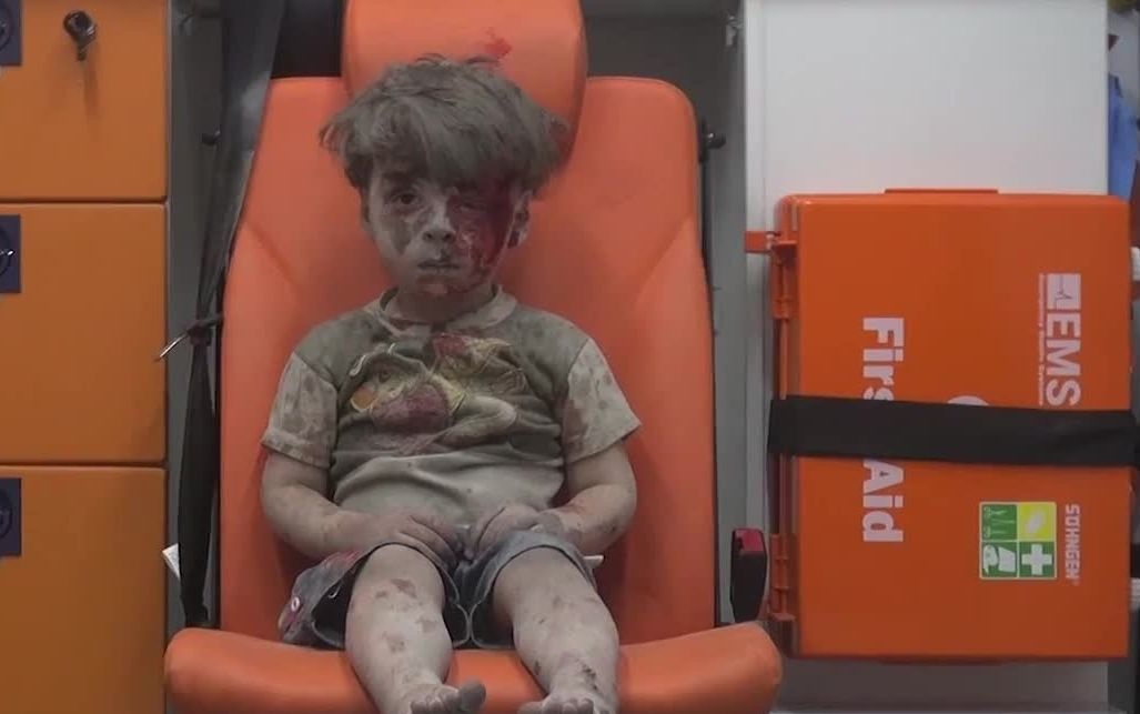 Семья ребенка, названного СМИ «символом страданий Сирии», поддержала Асада