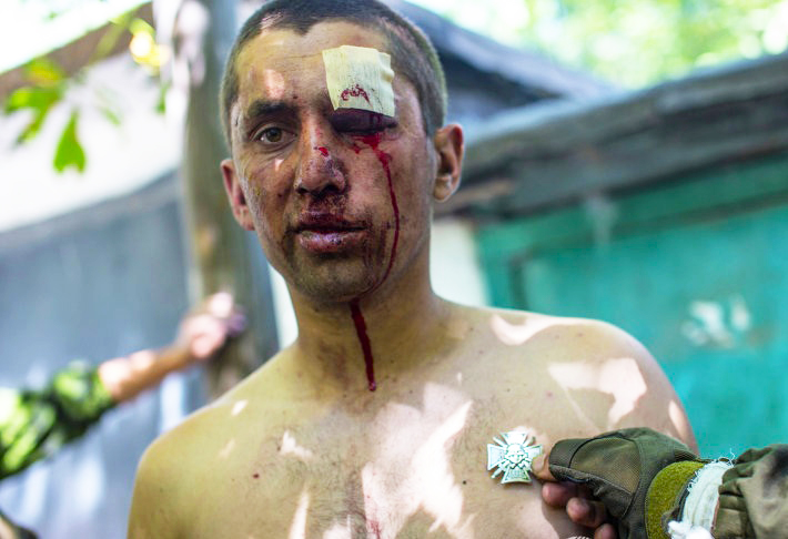 Несколько «кругов ада»: чудовищные издевательства над пленными на Украине