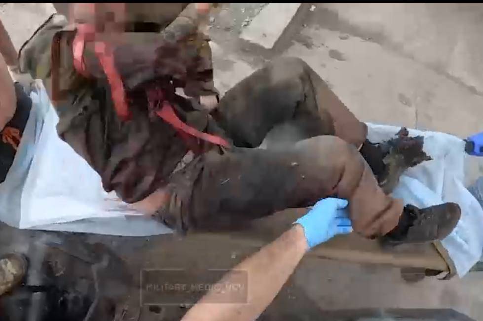 Боец СВО отрезал себе руку после подрыва на мине и шёл километр до медиков
