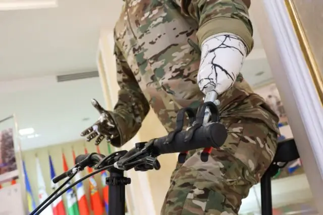 Технологии для жизни: в регионах России запустили сеть протезирования